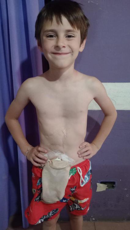 nene1