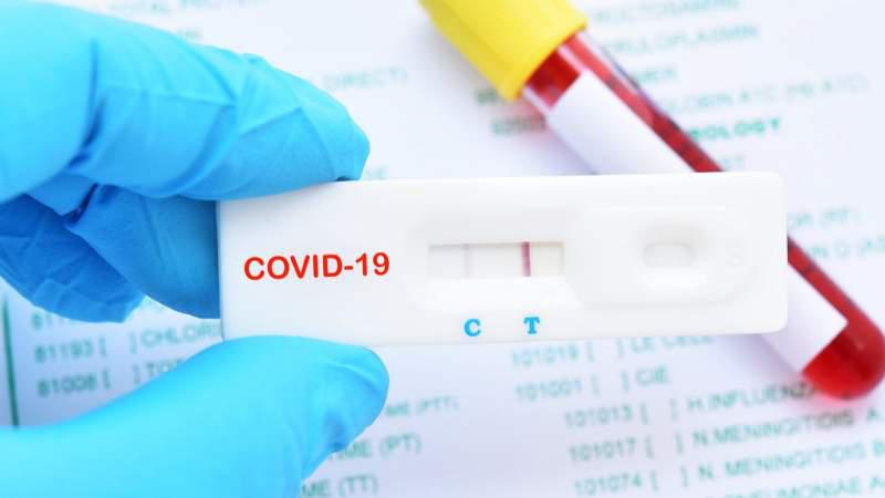 COVID-19