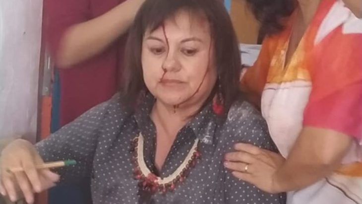 MA